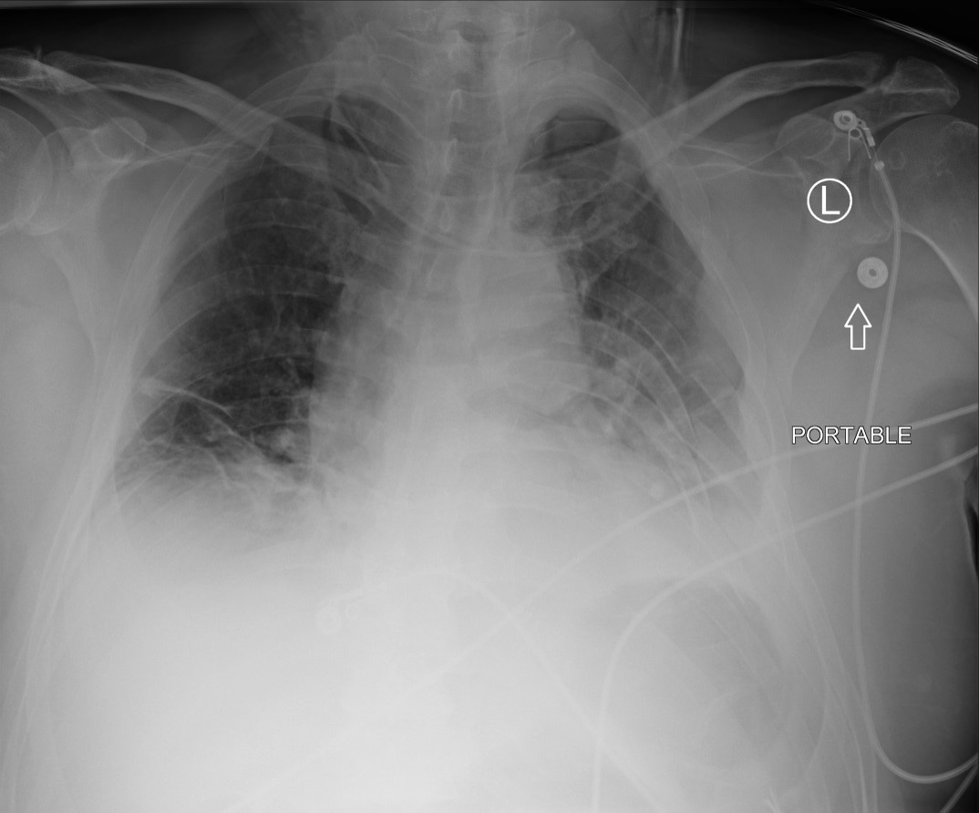 Left X-Ray