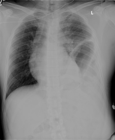 Right X-Ray